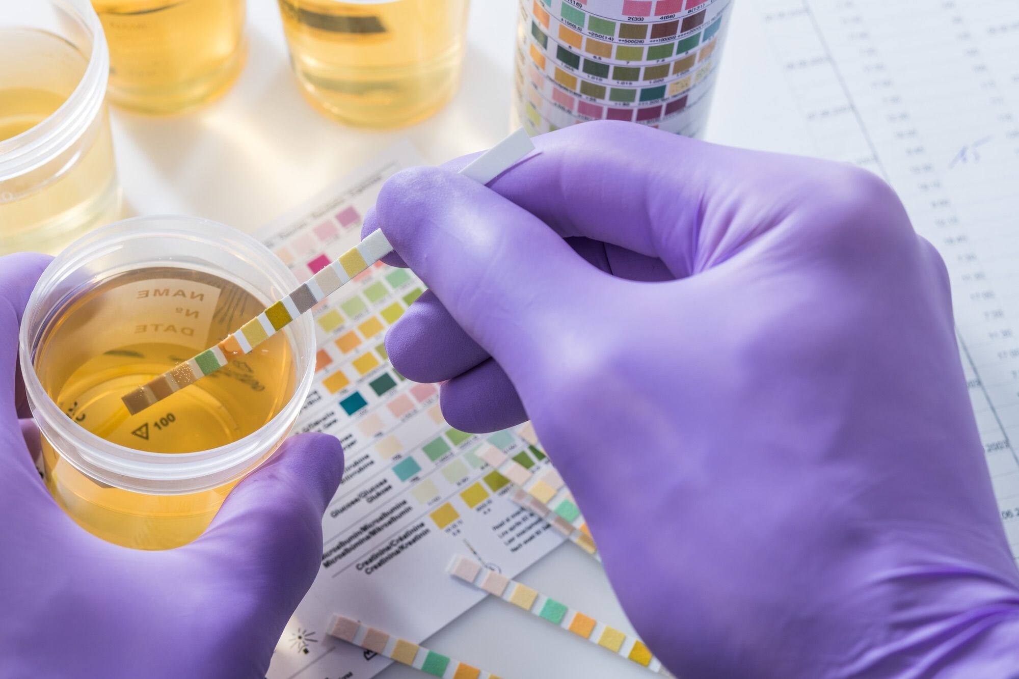 Codice della Strada: stupefacenti e farmaci trattati allo stesso modo