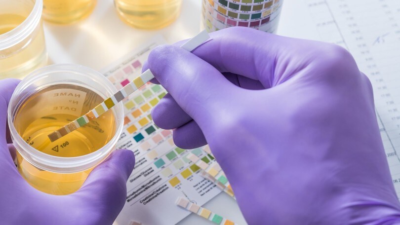 Codice della Strada: stupefacenti e farmaci trattati allo stesso modo