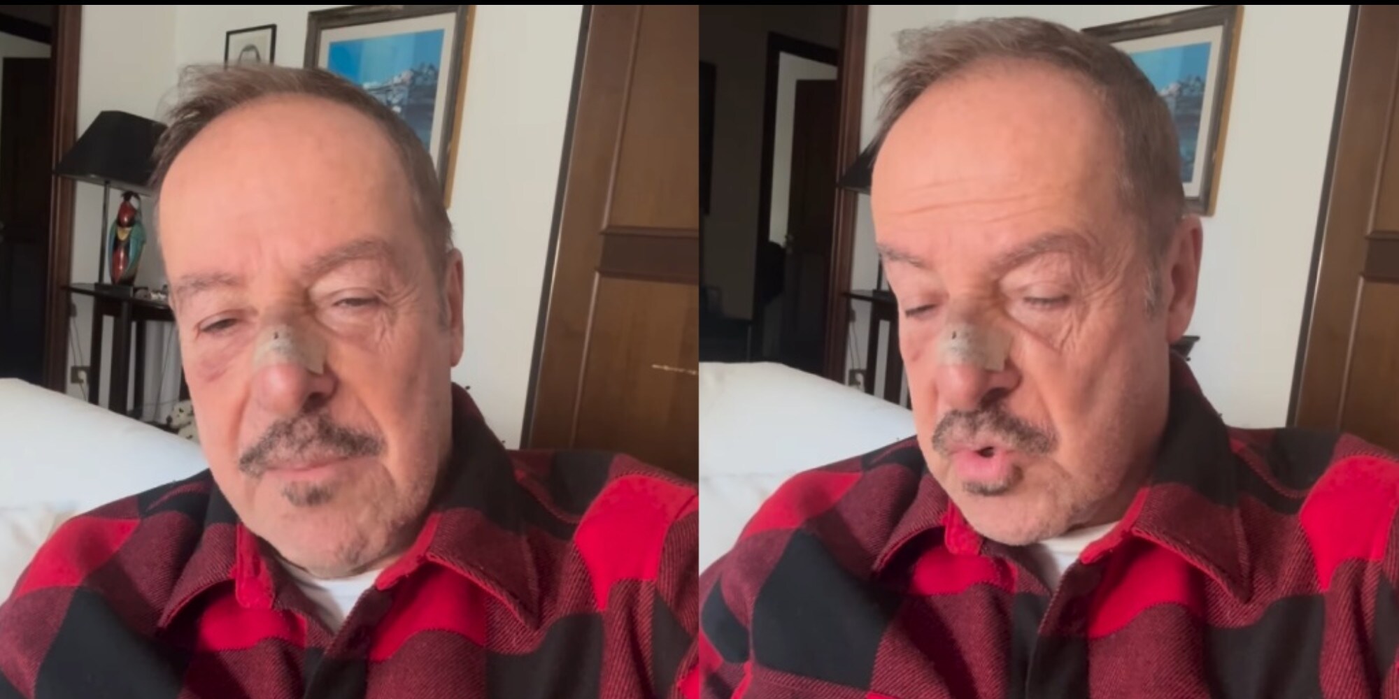 Paura per Massimo Lopez, investito a Roma da una moto pirata