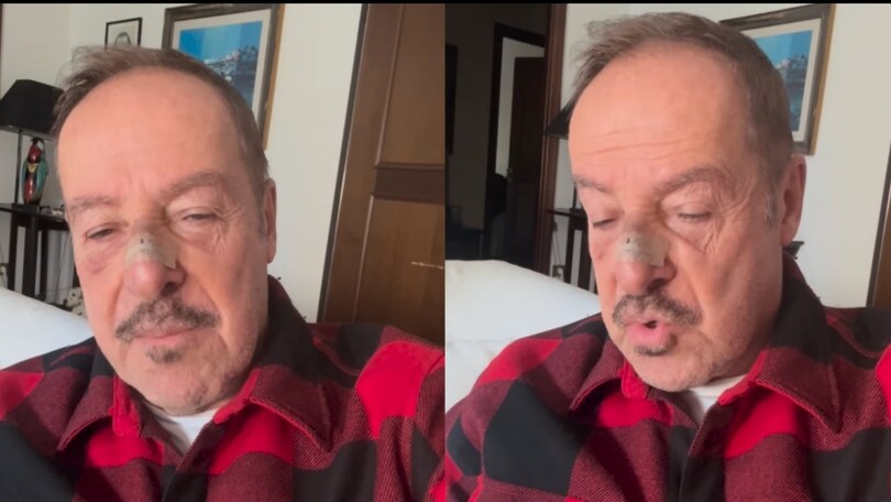 Paura per Massimo Lopez, investito a Roma da una moto pirata